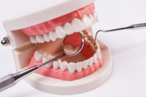Tips to Choose the Right Dentist