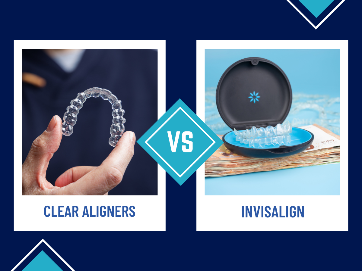 Clear Aligners vs Invisalign