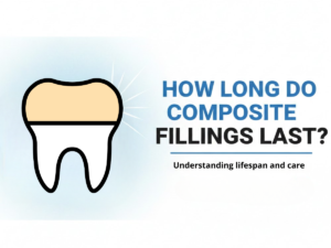 Lifespan of composite fillings explained by a cosmetic dentist